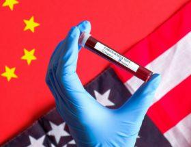 Kłamstwa i insynuacje. Chiny i USA szukają winnego pandemii 