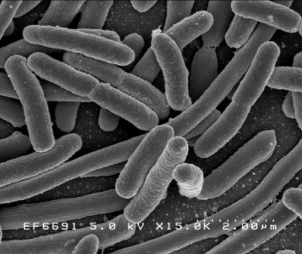 syntetyczne-dna-kodony-bakteria-escherichia-coli 