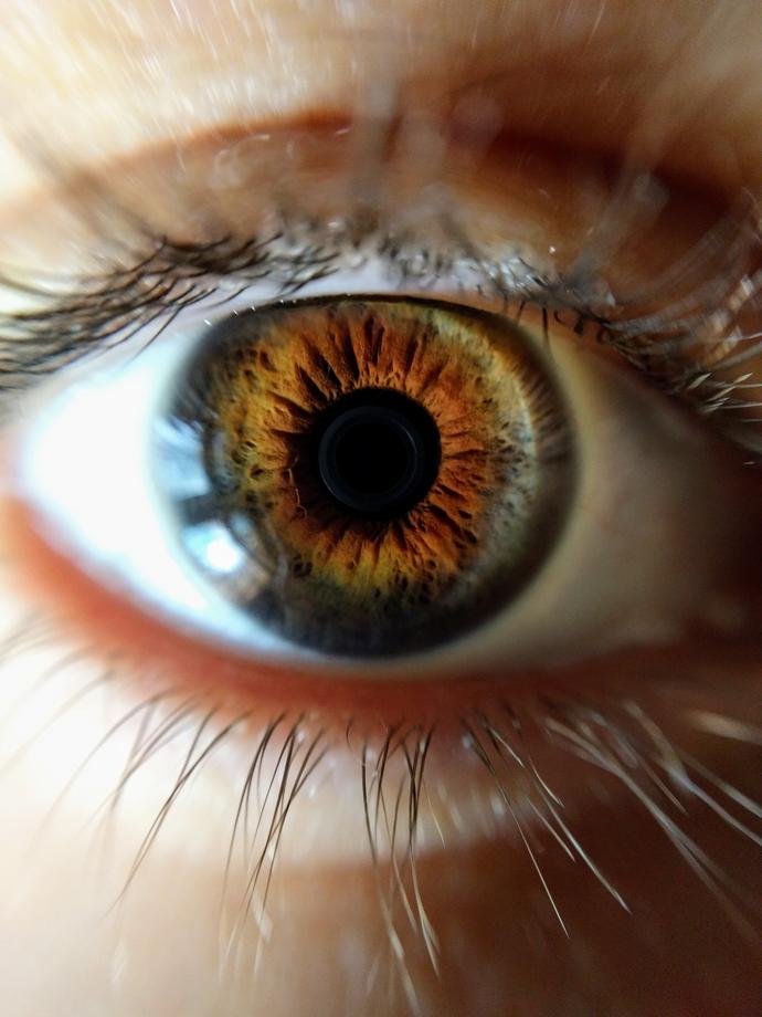 Bioniczne oko opracowane w Australii przywróci wzrok niewodomym. W mocno ograniczonej formie