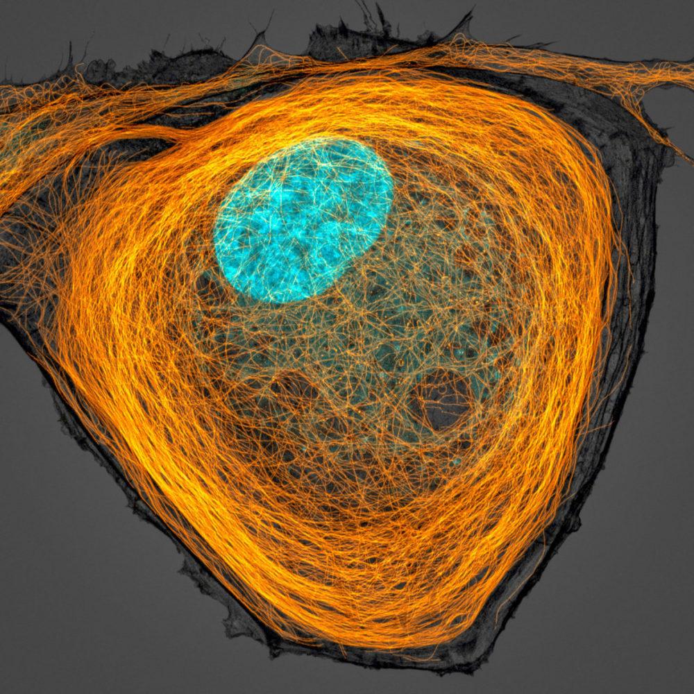 Fot. Jason Kirk, mikrotubule wewnątrz komórki, 7. miejsce 