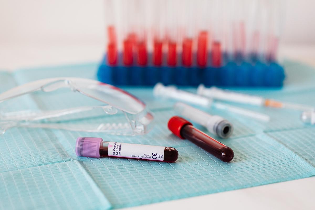 Nowy test krwi stworzony przez naukowców z Izraela brzmi jak Święty Graal diagnostów
