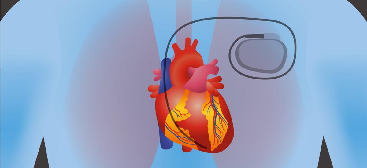 Apple ostrzega: nasze urządzenia mogą zakłócić pracę rozruszników serca