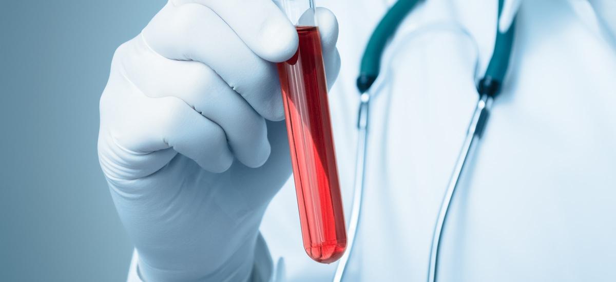 Nowe, łatwe badanie krwi wykrywa ponad 50 typów raka