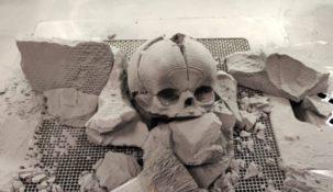 Polacy w 26 godzin wydrukowali czaszkę dziecka. Lekarze uratowali dziewczynkę 